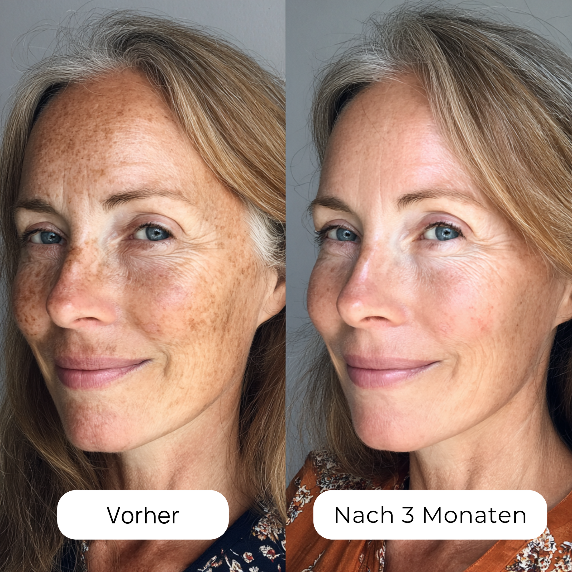 Bright C+ Vitamin Serum (30 ml)