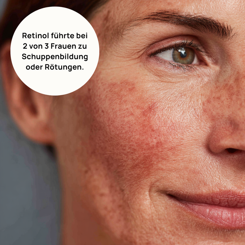 Retinol sollte Wunder wirken – doch für viele Frauen war es nur eine Enttäuschung